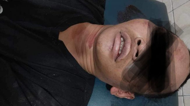 Tertangkap Basah Maling Sepeda Motor di Pasar Malam Selaawi Garut, Pelaku Curanmor ini Babak Belur Dihajar Warga