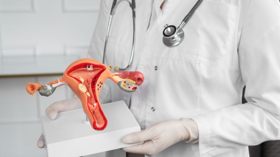 Mengenal Apa Itu PCOS dan Tandatanda yang Terjadi Pada Wanita