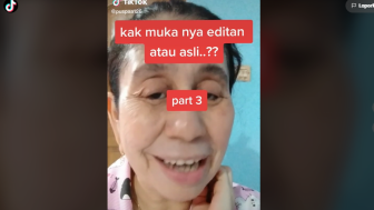 Cerita Wajah Puspa Sari Lebih Tua Dari Usianya Berawal dari Biduran, Lalu...