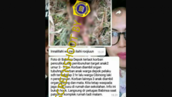 FAKTA Sebenarnya Foto-foto Bocah Korban Penculikan Dipreteli Organ Tubuhnya