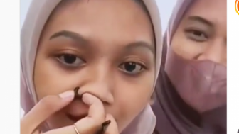 Ngeri! Cewek Cengengesan Ini Tak Sadar Lintah Masuk Lubang Hidungnya