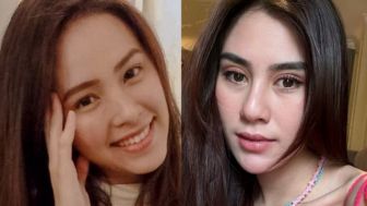 Fokus Selesaikan Proses Cerai dengan Rendy Kjaernett, Lady Nayoan Tak Butuh Permintaan Maaf dari Syahnaz