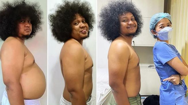 Perut Tak Lagi Buncit, Berat Badan Turun 29 Kg, Babe Cabita Ternyata Alami Ini