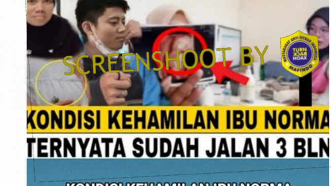 CEK FAKTA: Ibu Norma Risma Disebut Hamil Tiga Bulan hasil Hubungan Gelap dengan Menantunya, Benarkah?