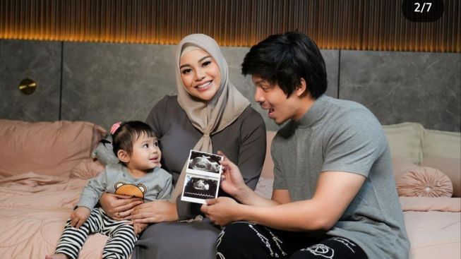 Usia Masuk 4 Bulan, Aurel Hermansyah Hamil Anak Kedua