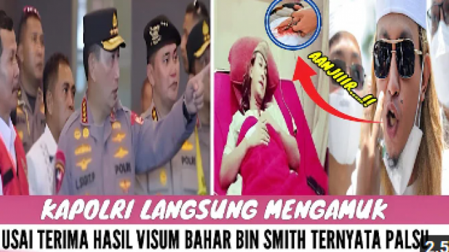 CEK FAKTA: Merasa Dibohongi, Kapolri Mengamuk Ternyata Hasil Visum Bahar bin Smith Palsu