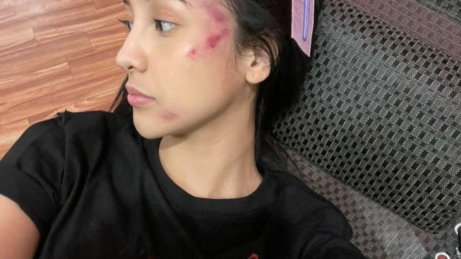 Anya Geraldine Ngaku Kejatuhan Pohon Durian, Netizen: Durennya yang Beruntung Tuh!