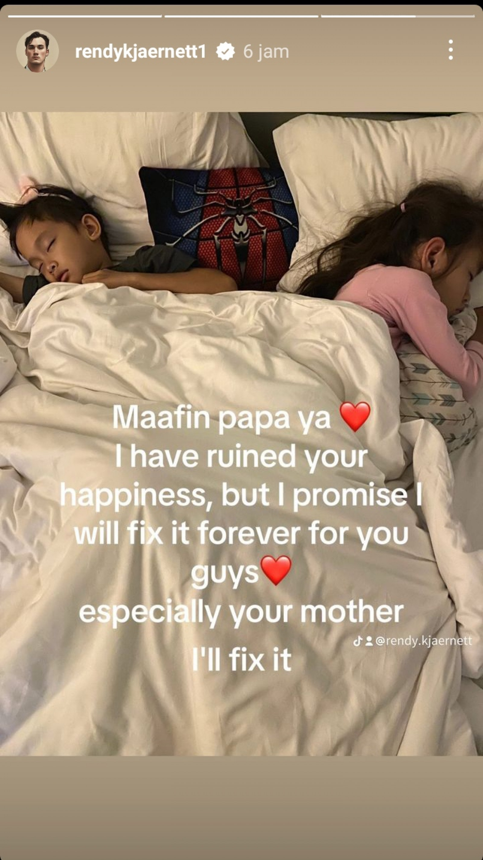 Postingan Instagram Story Rendy Kjaernett