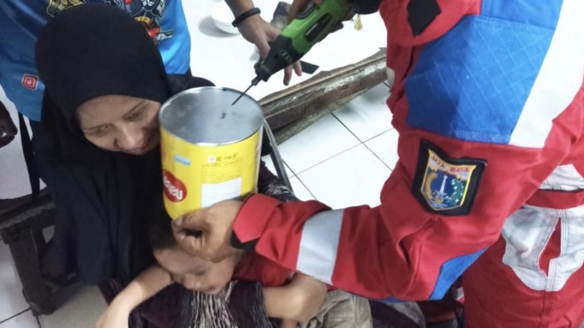 Seorang bocah bernama Bisma (2), menangis histeris saat kaleng biskuit menyangkut di kepalanya. (Foto dok. petugas)