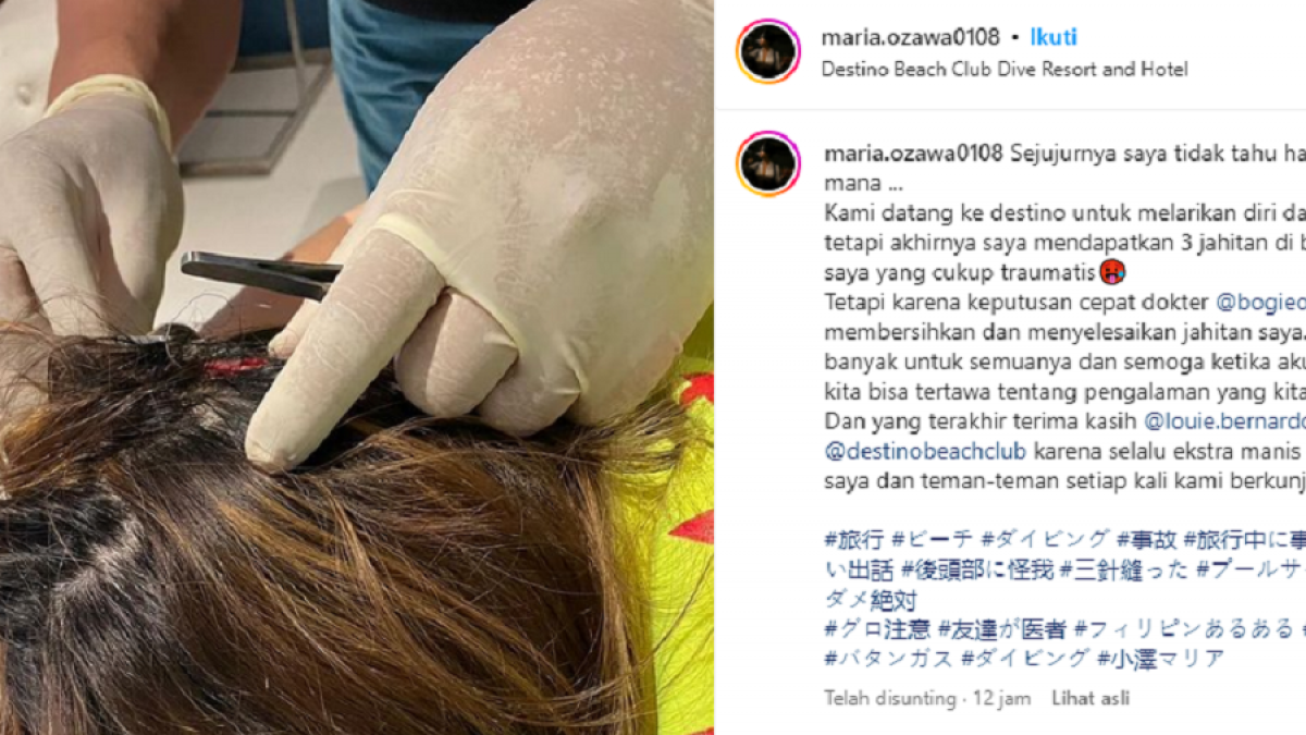 Maria Ozawa kecelakaan hingga kepalanya harus dijahit [Instagram @maria.ozawa0108]
