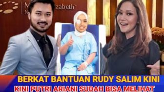 Cek Fakta: Berkat Bantuan Rudy Salim, Kini Putri Ariani Sudah Bisa Melihat