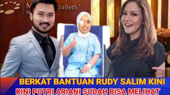 Cek Fakta: Berkat Rudi Salim, Putri Ariani Operasi Mata di Luar Negeri hingga Sudah Bisa Melihat