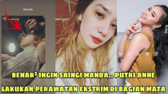 Cek Fakta: Putri Anne Lakukan Perawatan Ektream demi Saingi Amanda Manopo