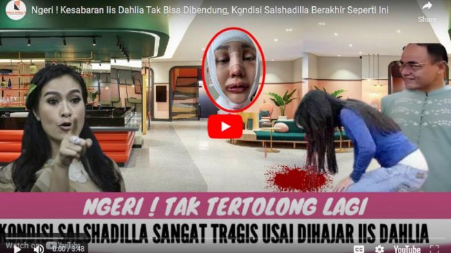 Cek Fakta: Ngeri! Kesabaran Iis Dahlia Habis, Hajar Salshadilla Juwita hingga Babak Belur