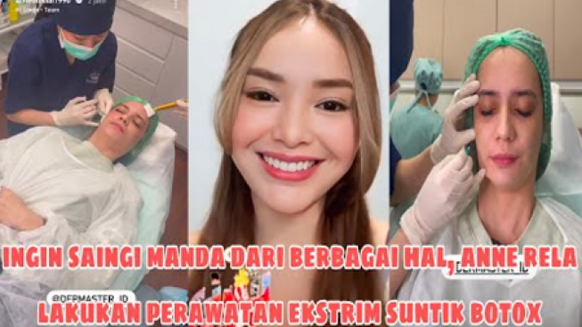 Putri Anne Rela Lakukan Suntik Botox demi Saingi Kecantikan Amanda Manopo dan Rebut Kembali Arya Saloka, Cek Faktanya!