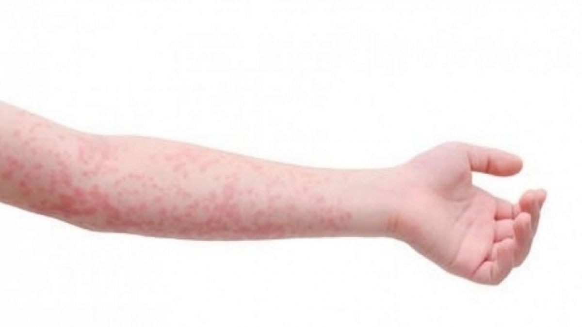 Ruam [HxBenefit] [HxBenefit]