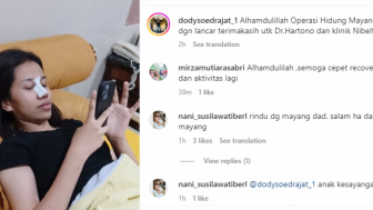 Doddy Sudrajat Bersyukur Mayang Jalani Operasi Hidung, Netizen Malah Kasihan: Diperalat Bapaknya