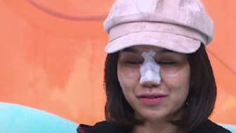 Mayang Unggah Potret Lawas Sebelum Lakukan Operasi Hidung: Cantikan Dulu, Semoga Nggak Ada Efek Samping Deh