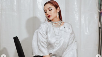 Bantah Lakukan Operasi Plastik, Siti Badriah: Cuma Filler Bibir, Dagu Terus Botox