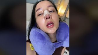 Lucinta Luna Operasi Hidung Lagi, Warganet Takjub: Kuat Dia