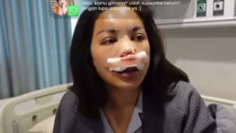 Jessica Iskandar Curhat Susah Bernapas Usai Oplas Hidung, Netizen Masih Ingatkan Masalah Utang