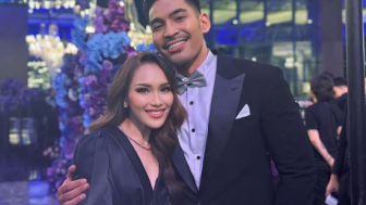 Perawatan Hingga Ratusan Juta, Wajah Ayu Ting Ting Justru Dianggap Beda: Cantikan Dulu