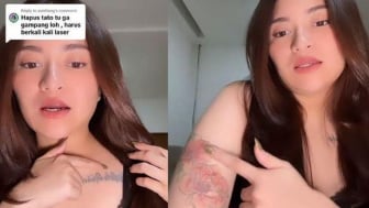 Ungkit Pengorbanan Buat Sule, Nathalie Holscher Tunjukkan Bekas Tato yang Sudah Dihapus: Sakit Banget