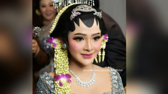 Bella Bonita Mendadak Tumbang Usai Acara Ngunduh Mantu, Diduga Lagi Hamil Muda