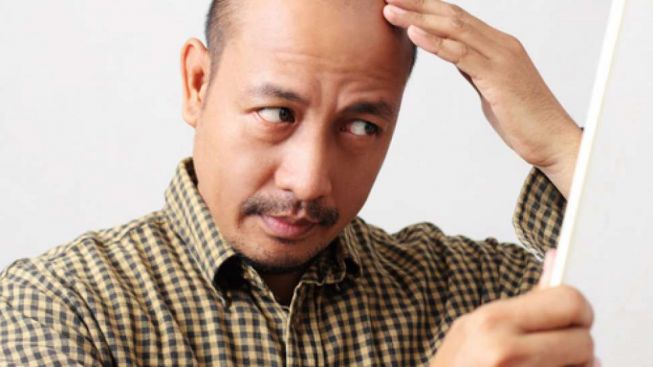 Gak Ribet, Ini 5 Tips Mencegah Kebotakan Pada Pria
