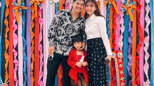 Chelsea Olivia Kecelakaan hingga Sebabkan Tulang Ekor Geser: Takut Banget Nggak Bisa Jalan