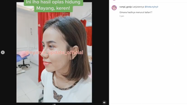 Ini Potret Terbaru Mayang Adik Vanessa Angel Pasca Operasi Hidung, Disebut Mirip Barbie Kumalasari