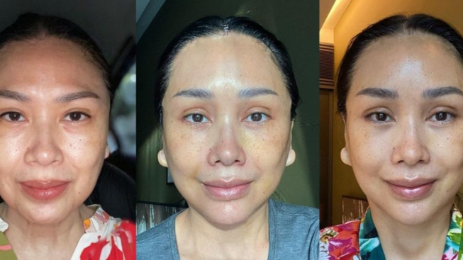 Netizen Pangling, Wajah Titi DJ Makin Muda dan Nyaris Tak Dikenali Setelah Operasi Anti Aging