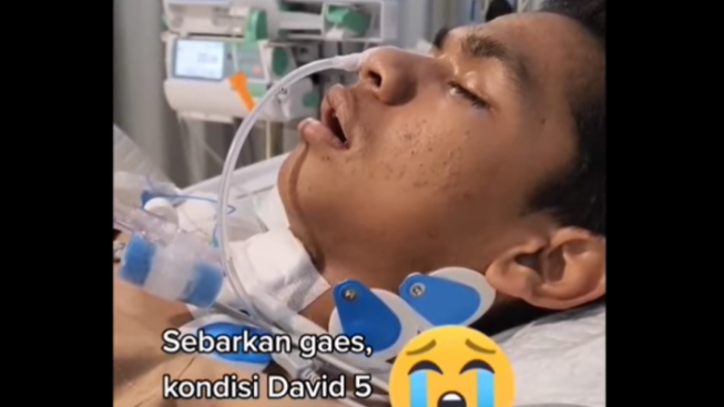 Hampir Dua Minggu Tidak Sadarkan Diri, Begini Kondisi Terbaru David Ozora