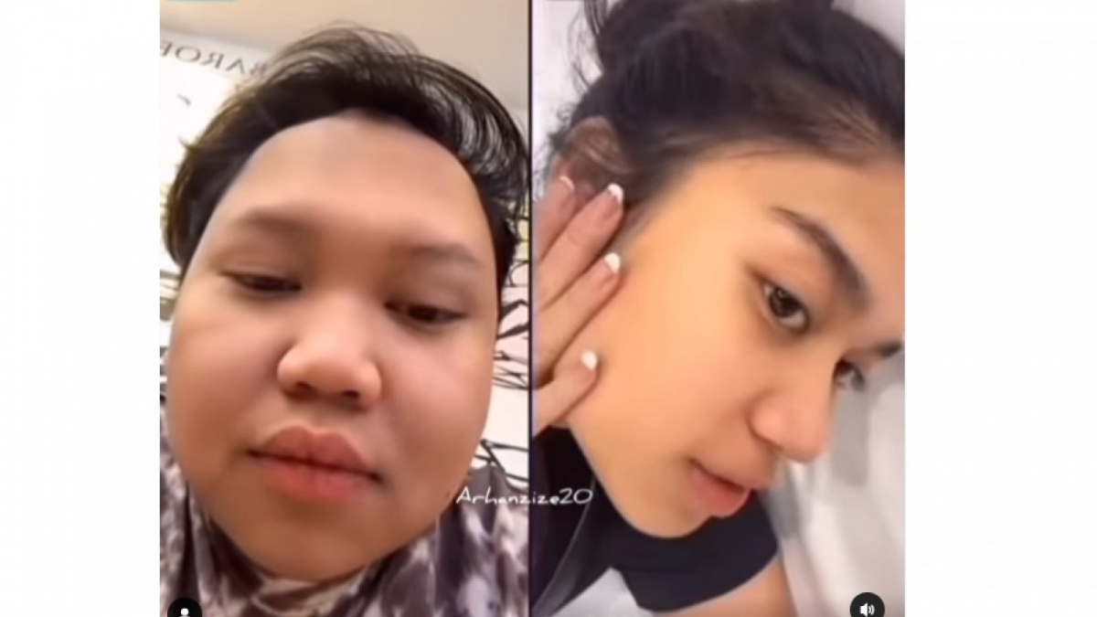 Postingan Azizah Salsha yang mengaku dirinya terlihat sangat kurus [(Instagram/@arhanzize20)]