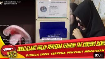 CEK FAKTA: Geger! Syahrini Mengidap Penyakit Mematikan