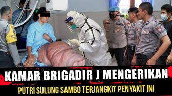 CEK FAKTA: Kakinya Bengkak, Anak Ferdy Sambo Terkena Azab Penyakit Langka