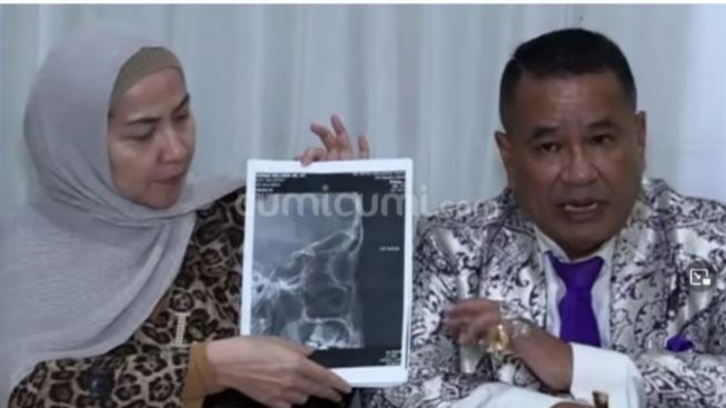 Venna Melinda Disebut Kenal dengan Dokter yang Tangani Hasil Visum, Ibunda Ferry Irawan Tak Puas