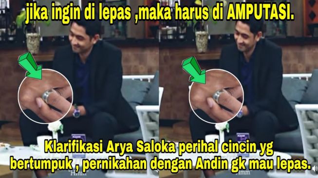 CEK FAKTA: Harus Diamputasi, Arya Saloka Tak Bisa Lepas Cincin Pernikahan dengan Amanda Manopo di Jarinya