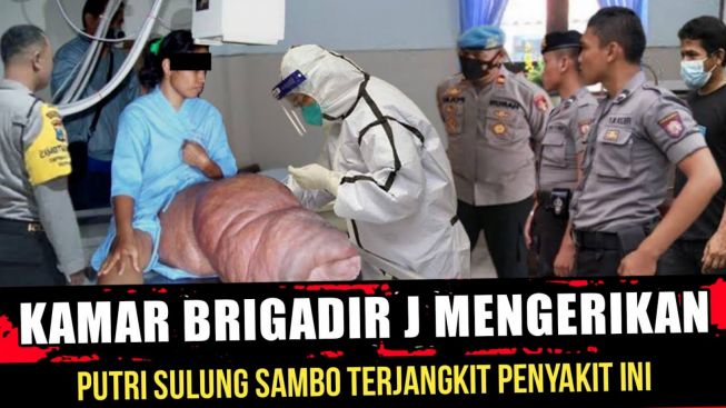 CEK FAKTA: Azab Tuhan Mengerikan, Putri Sulung Ferdy Sambo Terjangkit Penyakit Mengerikan