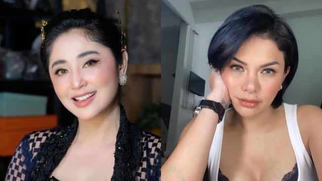 Calon Suami Diejek Mirip Suneo, Dewi Perssik Balas Cela Nikita Mirzani: Bibir Banyak Filler!