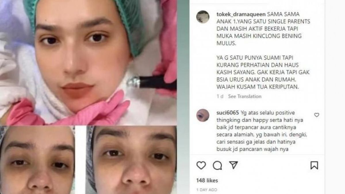 Ptret Putri Anne  dan Mayang Yudittia usai perawatan wajah. [Instagram]