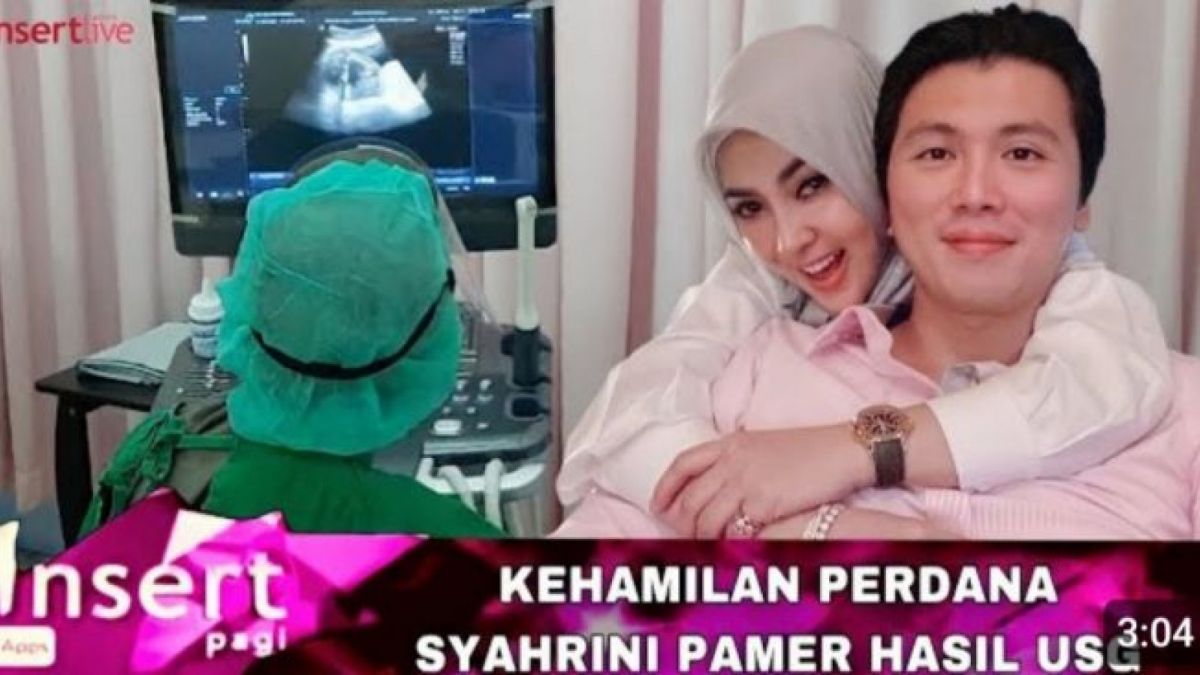 CEK FAKTA: Syahrini Hamil Anak Pertama, Reino Barack Pamer Hasil USG di