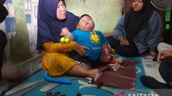 Heboh Bayi 16 Bulan di Bekasi Punya Berat Badan 27 Kg, Bobotnya Setara Anak Usia 11 Tahun