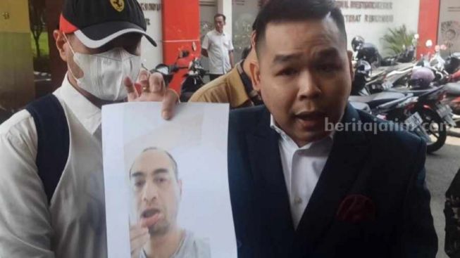 Bantah Lakukan KDRT pada Venna Melinda, Ferry Irawan Bawa Foto Bibir Sobek Akibat Dicakar