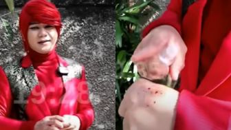 Pengobatan Ida Dayak Viral, Pesulap Merah Bongkar Trik: Hanya Minyak yang Berubah Warna