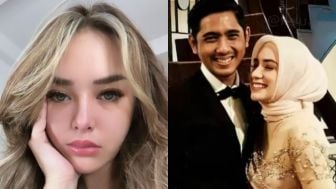 Kakak Amanda Manopo Beri Sinyal ke Putri Anne, Pastikan sang Adik Tidak Ganggu Kebahagiaannya