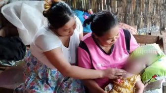 Bayi Tanpa Tempurung di Ponorogo Meninggal Dunia: Upaya Penanganan Medis Dilakukan, Namun Tak Berhasil"