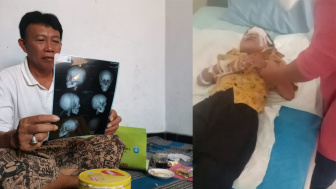 Tragedi Layang-Layang di Ponorogo: Anak 7 Tahun Mengalami Cedera Serius
