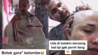 Sedih! Wanita Ini Rela Botak Demi Bebas dari Ketombe