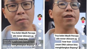 dr.Richard Kena Hujat Warganet, Wajah Aslinya Terungkap: Tak Seglowing di Kamera